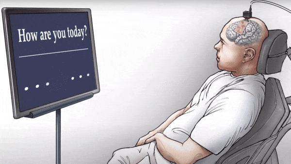 Listening to the Brain: NLP System Translates a Man's Brain Activity Into Words