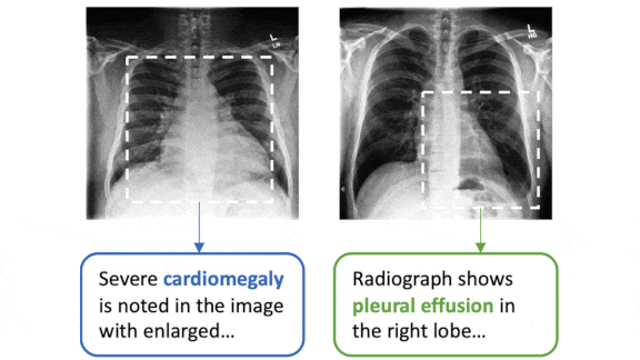 Learning From Words and Pictures: A deep learning method for medical x-rays with text