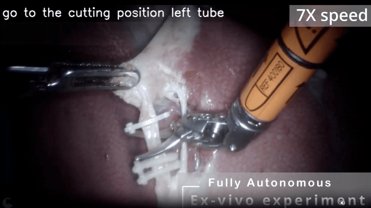 Robot Surgeon Cuts and Clips: Doctors at Stanford, Johns Hopkins, and Optosurgical operate on animal organs without human intervention